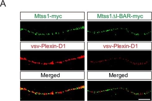 Detection of Mouse Plexin D1 by Immunohistochemistry