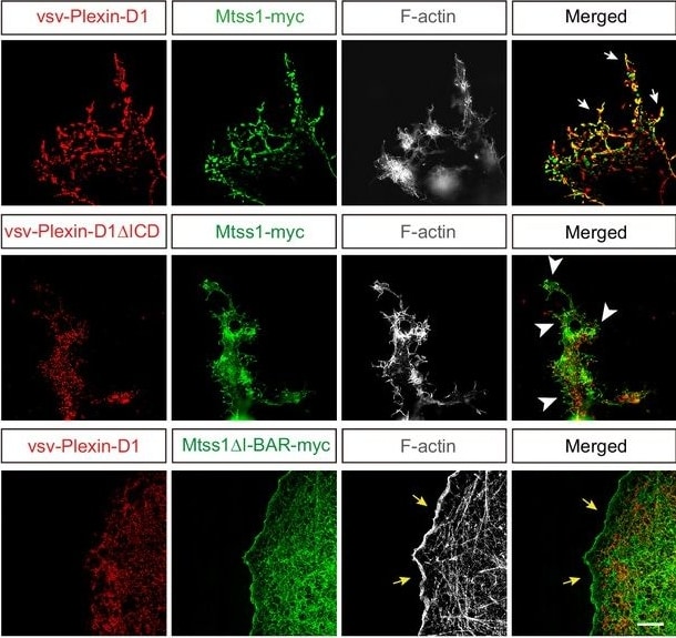 Detection of Mouse Plexin D1 by Immunohistochemistry