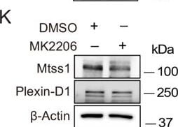Detection of Plexin D1 by Western Blot
