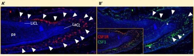 Detection of M-CSF by Immunohistochemistry