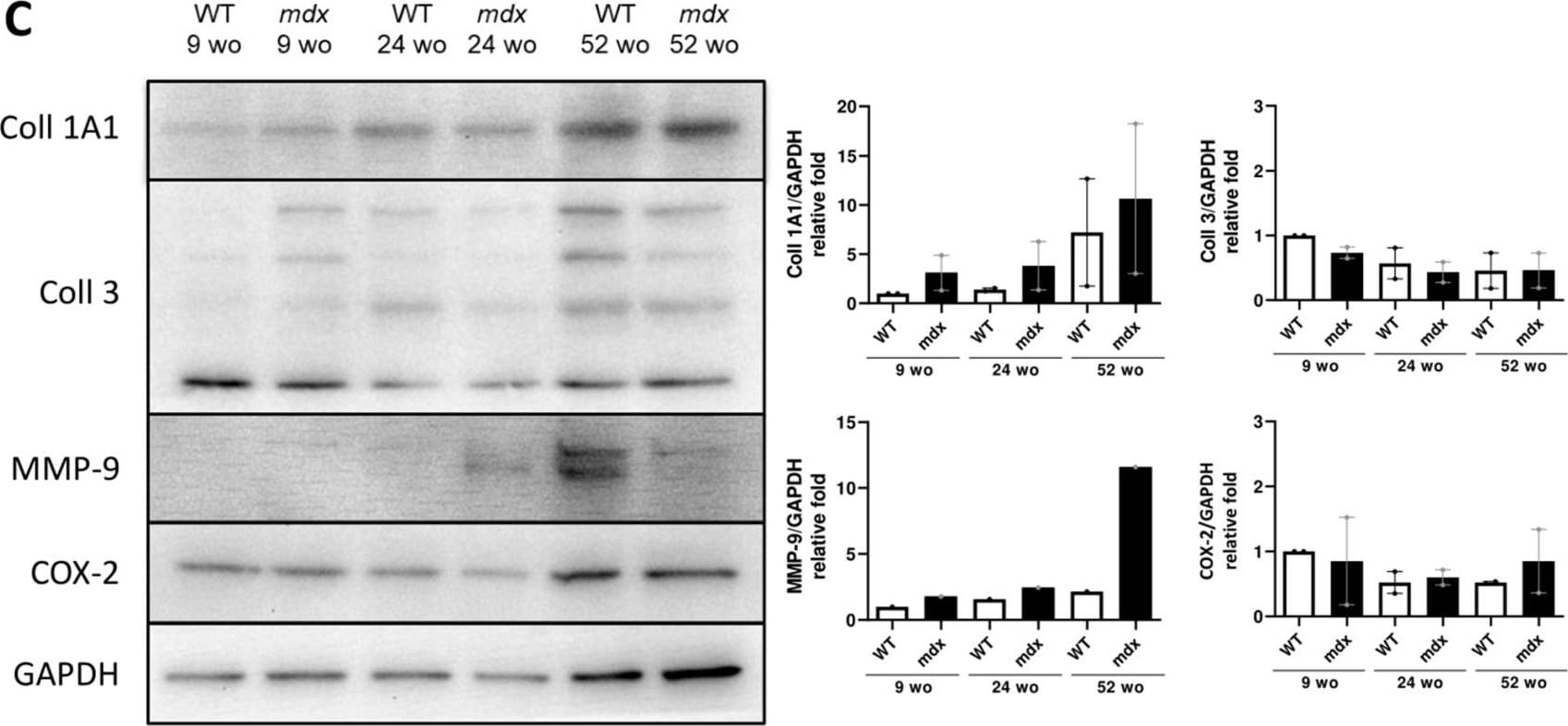 Detection of Mouse COX-2 by Western Blot