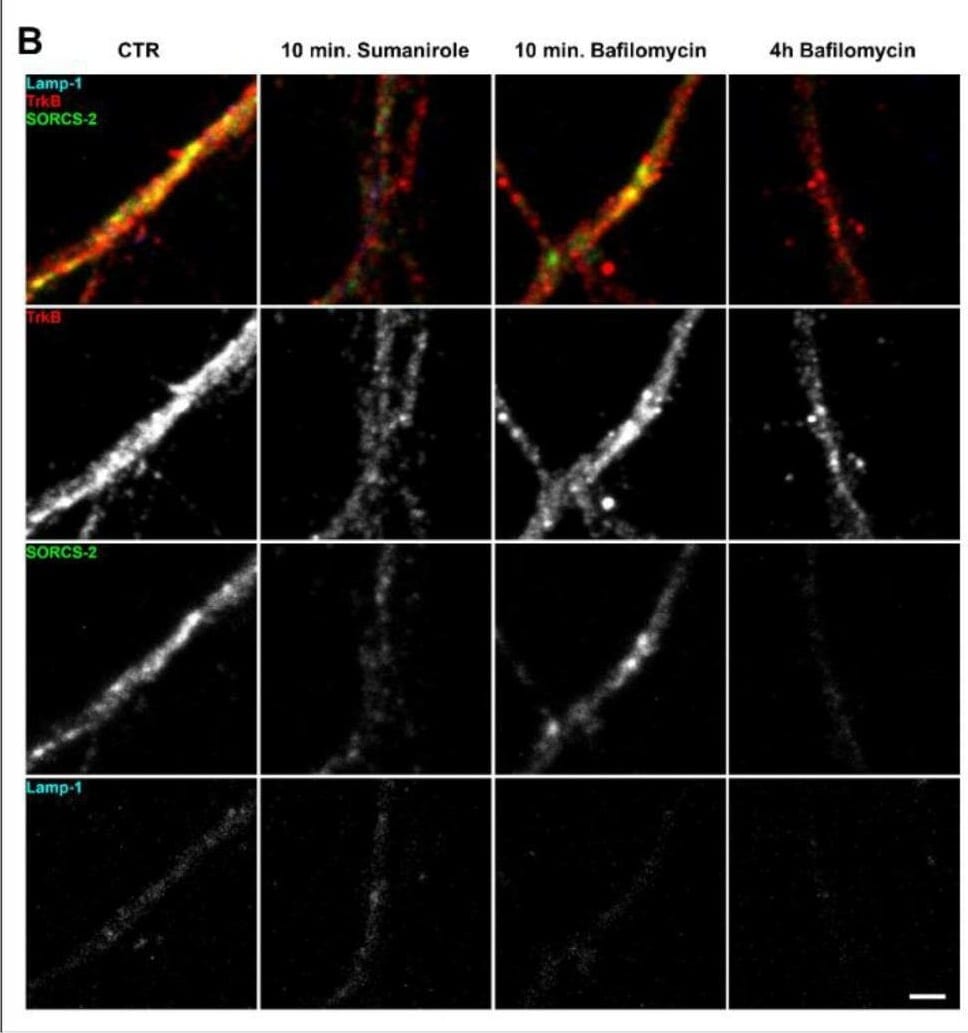 Detection of SorCS2 by Immunocytochemistry/ Immunofluorescence