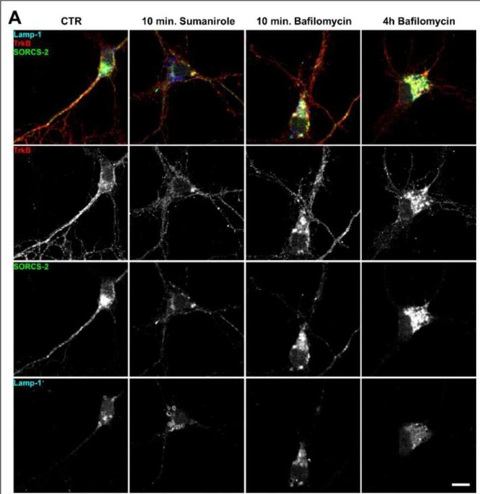 Detection of SorCS2 by Immunocytochemistry/ Immunofluorescence