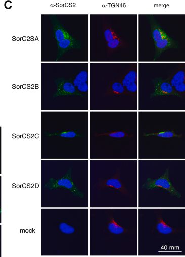 Detection of SorCS2 by Immunocytochemistry/ Immunofluorescence
