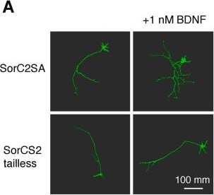 Detection of SorCS2 by Immunocytochemistry/ Immunofluorescence