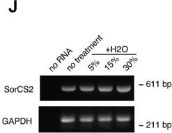 Detection of SorCS2 by Western Blot