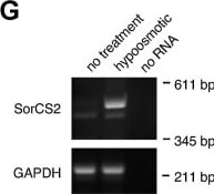 Detection of SorCS2 by Western Blot