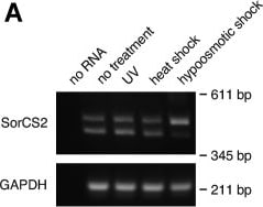 Detection of SorCS2 by Western Blot
