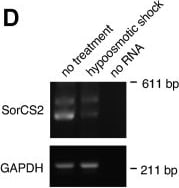 Detection of SorCS2 by Western Blot