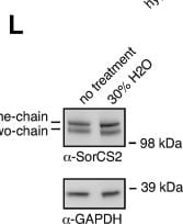 Detection of SorCS2 by Western Blot