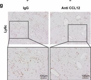 Detection of CCL12/MCP-5 by Immunohistochemistry