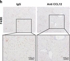 Detection of CCL12/MCP-5 by Immunohistochemistry