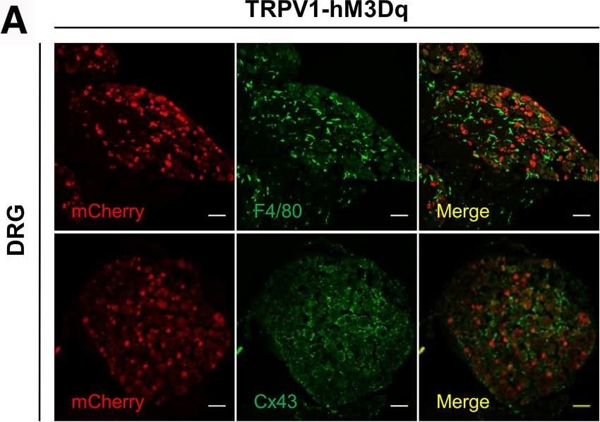 Detection of GFR alpha-2 by Immunocytochemistry/ Immunofluorescence