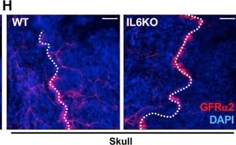 Detection of GFR alpha-2 by Immunohistochemistry
