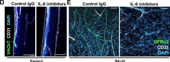 Detection of GFR alpha-2 by Immunohistochemistry