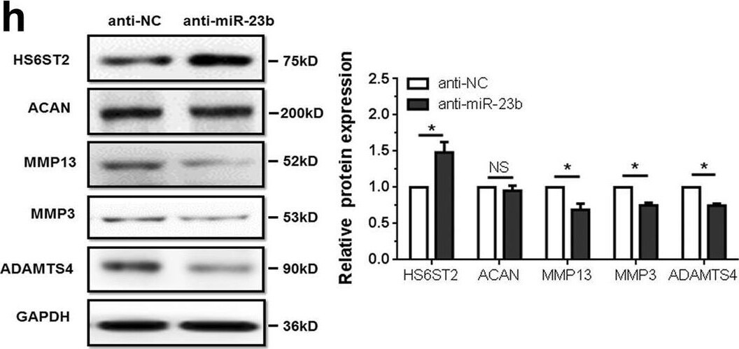 Detection of ADAMTS4 by Western Blot