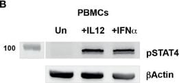 Detection of Phospho-STAT4 (Y693) by Western Blot