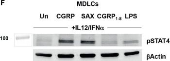 Detection of Phospho-STAT4 (Y693) by Western Blot