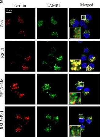 Detection of LAMP-1/CD107a by Immunocytochemistry/ Immunofluorescence