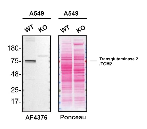 Western Blot Shows HumanTransglutaminase 2/TGM2 Specificity Using Knockout Cell Line.
