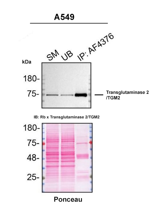 Detection of Transglutaminase 2/TGM2 by Immunoprecipitation.
