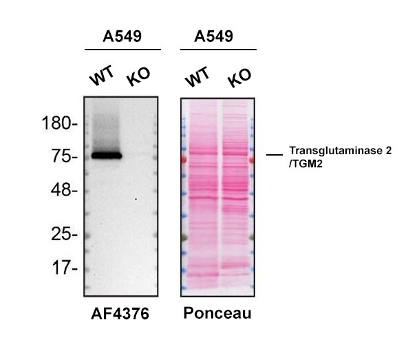 Western Blot Shows HumanTransglutaminase 2/TGM2 Specificity Using Knockout Cell Line.