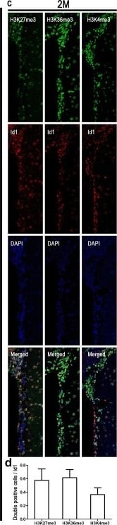 Detection of ID1 by Immunohistochemistry