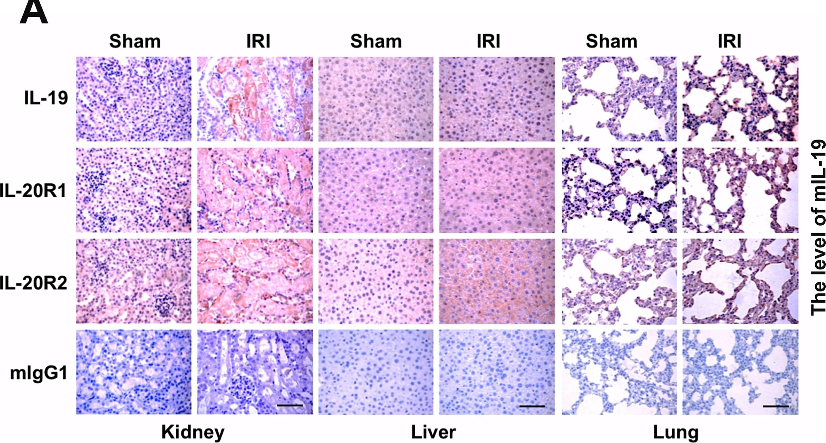 Detection of Mouse IL-20 R beta/FNDC6 by Immunocytochemistry/Immunofluorescence