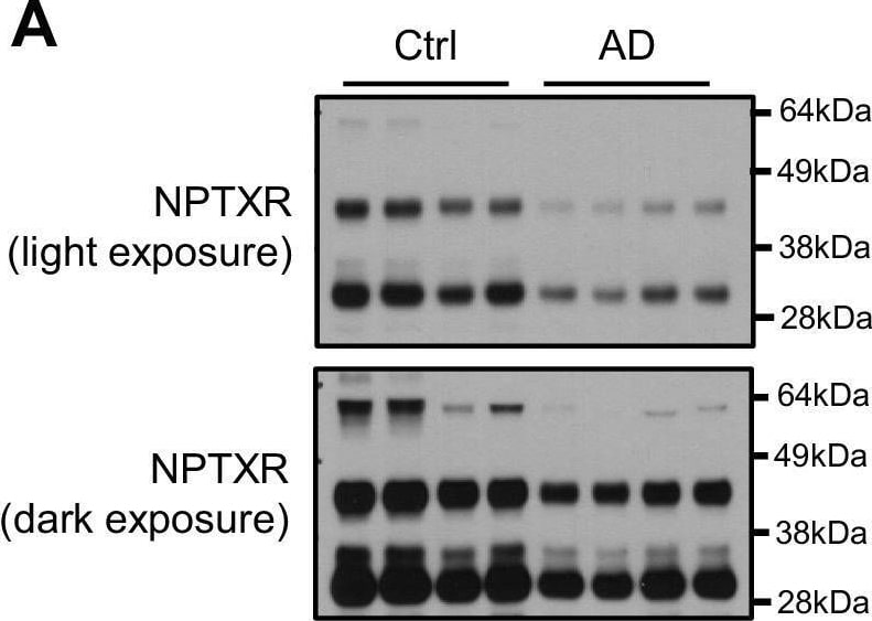 Detection of Neuronal Pentraxin R/NPTXR by Western Blot