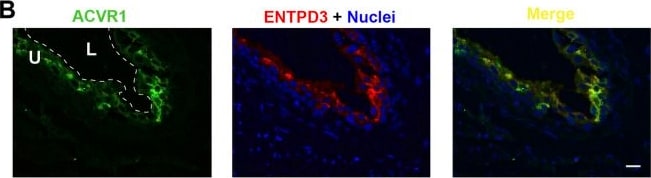 Detection of CD39L3/ENTPD3 by Immunohistochemistry