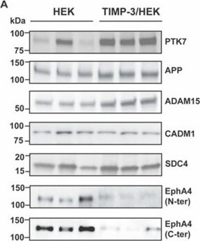 Detection of PTK7/CCK4 by Western Blot