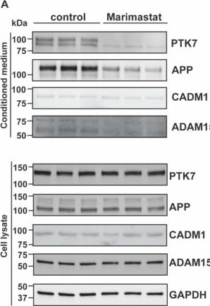 Detection of PTK7/CCK4 by Western Blot