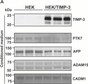 Detection of PTK7/CCK4 by Western Blot