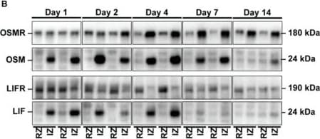 Detection of LIF by Western Blot