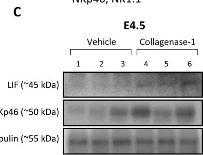 Detection of LIF by Western Blot