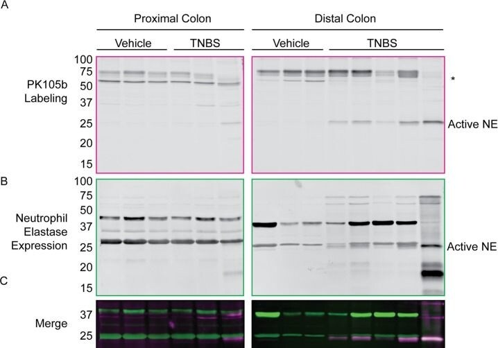Detection of Neutrophil Elastase/ELA2 by Western Blot