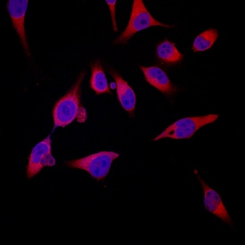 S100A8 antibody in HeLa Human Cell Line by Immunocytochemistry (ICC).