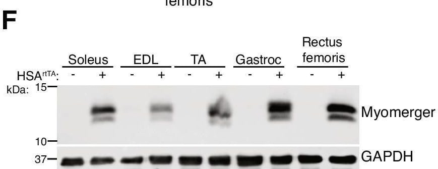 Detection of ESGP by Western Blot