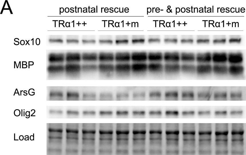 Detection of Mouse Arylsulfatase G/ARSG by Western Blot