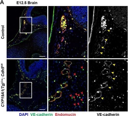 Detection of Mouse Endomucin/Mucin -14 by Immunohistochemistry