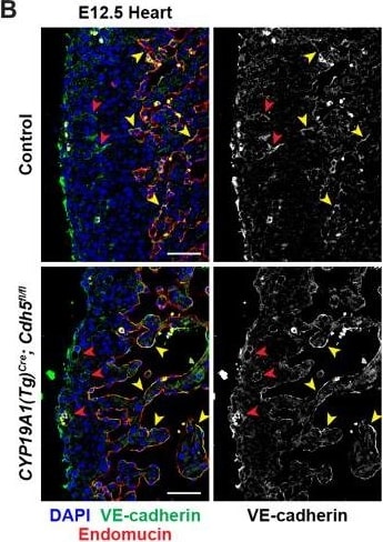 Detection of Mouse Endomucin/Mucin -14 by Immunohistochemistry