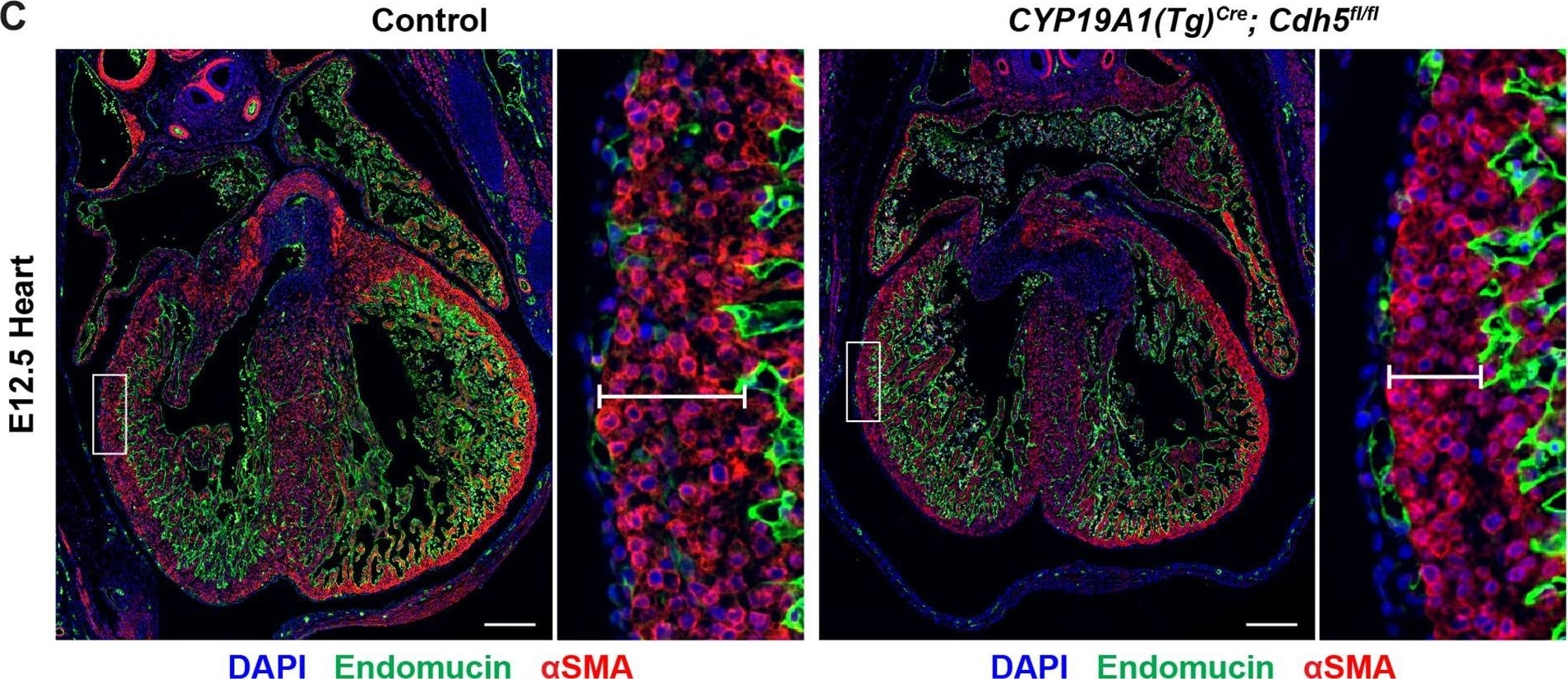 Detection of Mouse Endomucin/Mucin -14 by Immunohistochemistry