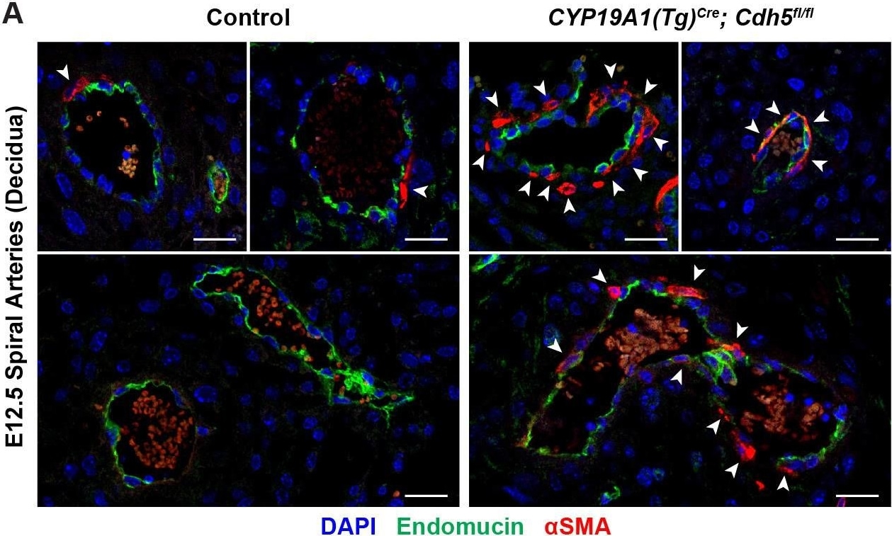 Detection of Mouse Endomucin/Mucin -14 by Immunohistochemistry
