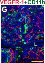 Detection of Mouse Mouse VEGFR1/Flt-1 Antibody by Immunohistochemistry