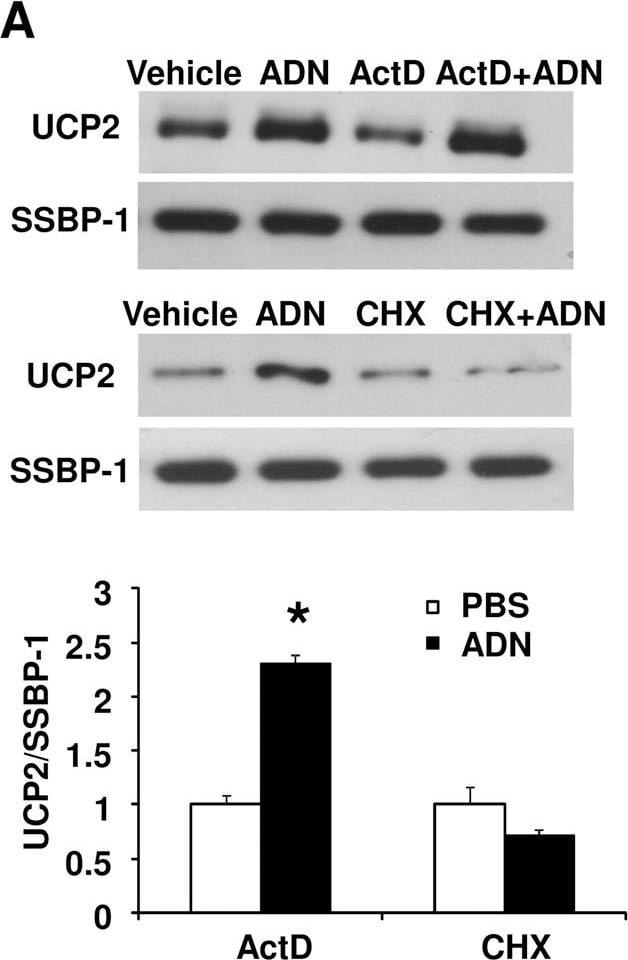 Detection of UCP2 by Western Blot