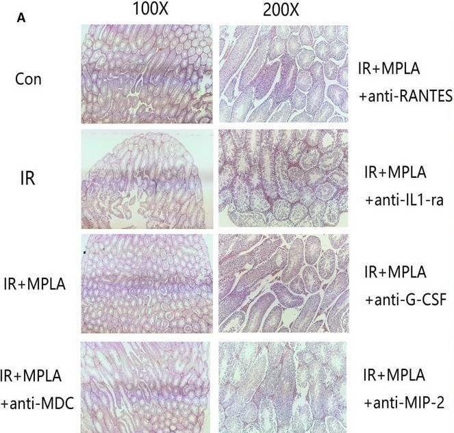 Detection of CCL5/RANTES by Immunohistochemistry