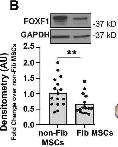 Detection of Human FoxF1 by Western Blot