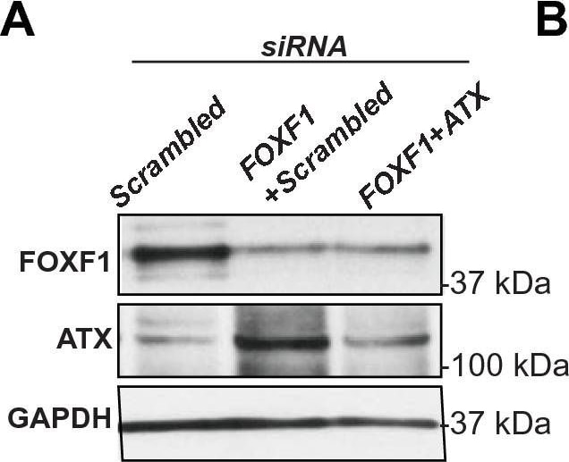 Detection of Human FoxF1 by Western Blot