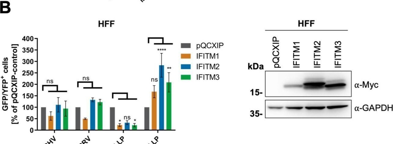 Detection of IFITM1 by Western Blot