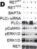 Detection of Mouse Ret by Western Blot